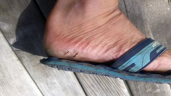 Close-up of a foot wearing a teal and black flip-flop, with a small cut on the heel. The foot rests on wooden planks, as if pausing during an adventurous road trip.