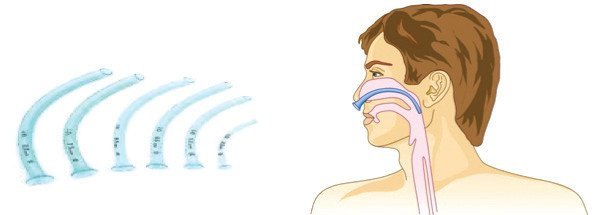 Nasopharyngeal airway