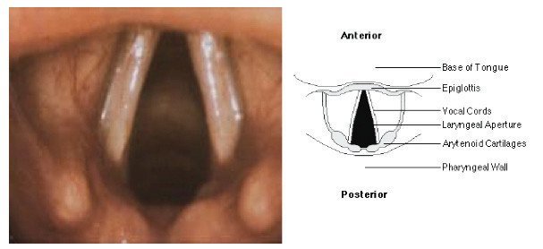 Laryngoscopic view