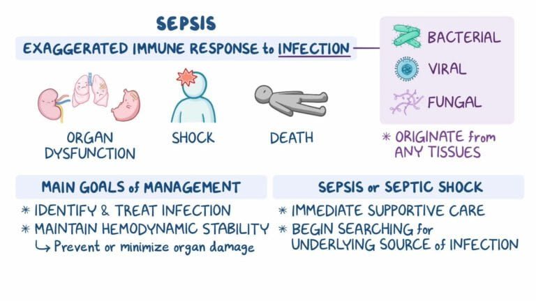 sepsis, septic shock diagnosis, management