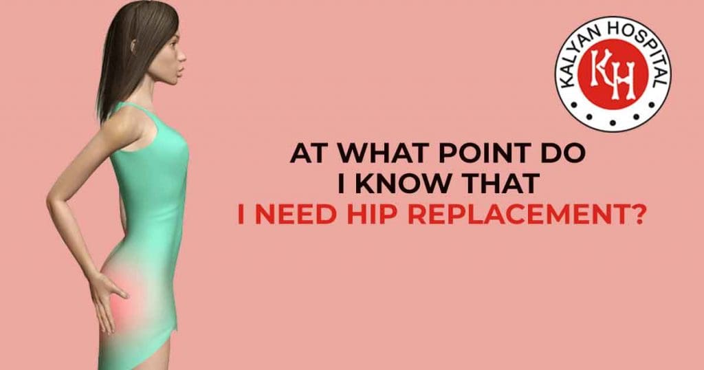 At What Point Do I know That I Need Hip Replacement?