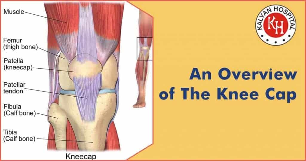 Pain relief and orthopedic care at Kalyan Hospital for knee cap injuries and conditions.
