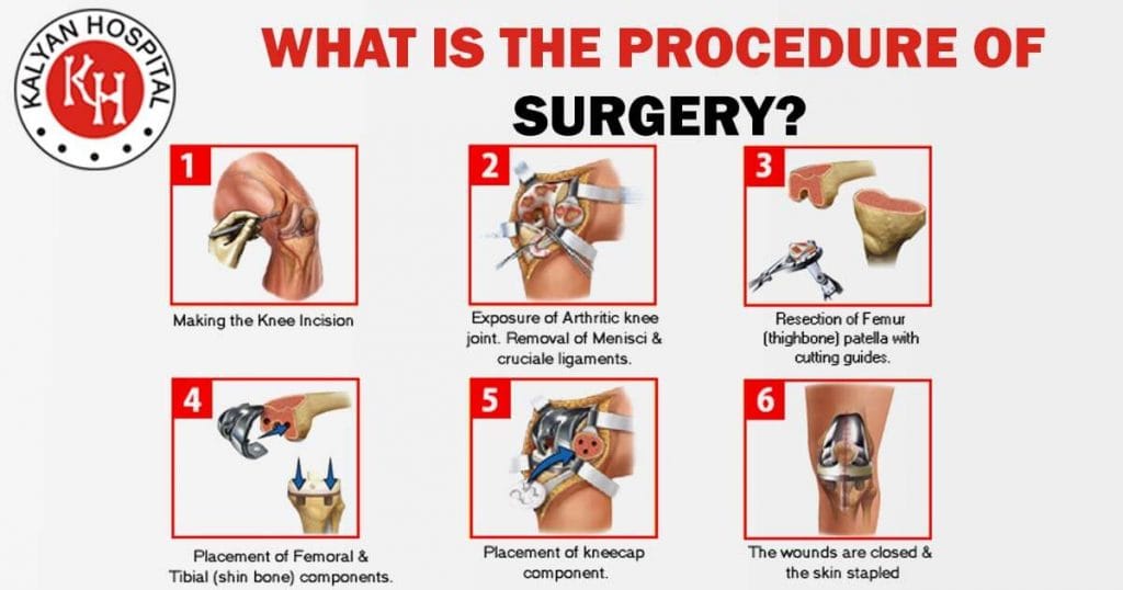 What is the procedure of surgery?