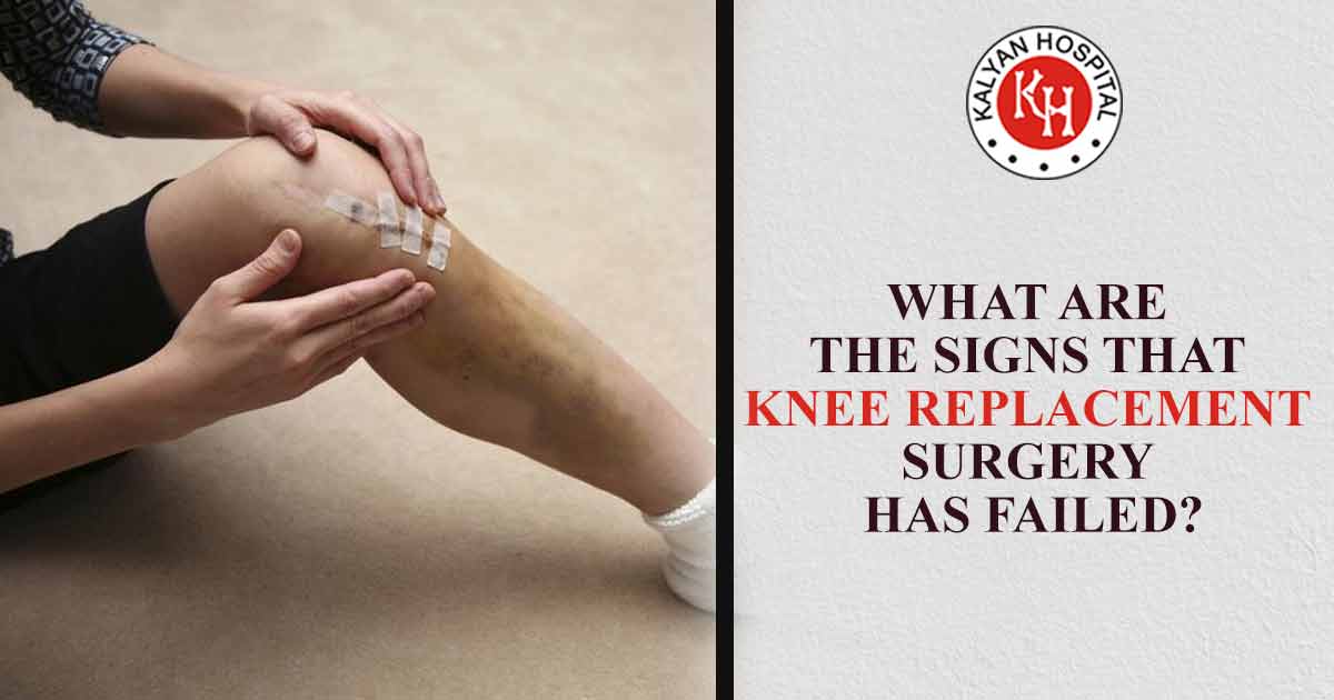 Knee replacement surgery symptoms, signs, knee pain, knee surgery recovery.