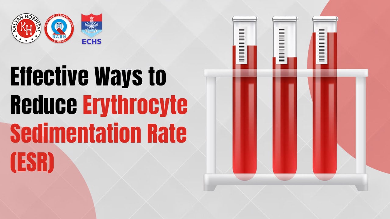 How to Effectively Manage and Lower Your ESR Levels