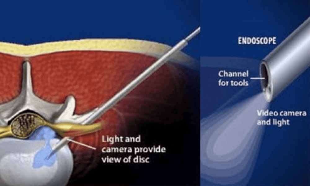 Endoscopic medical procedure at Kalyan Hospital for minimally invasive diagnosis and treatment.