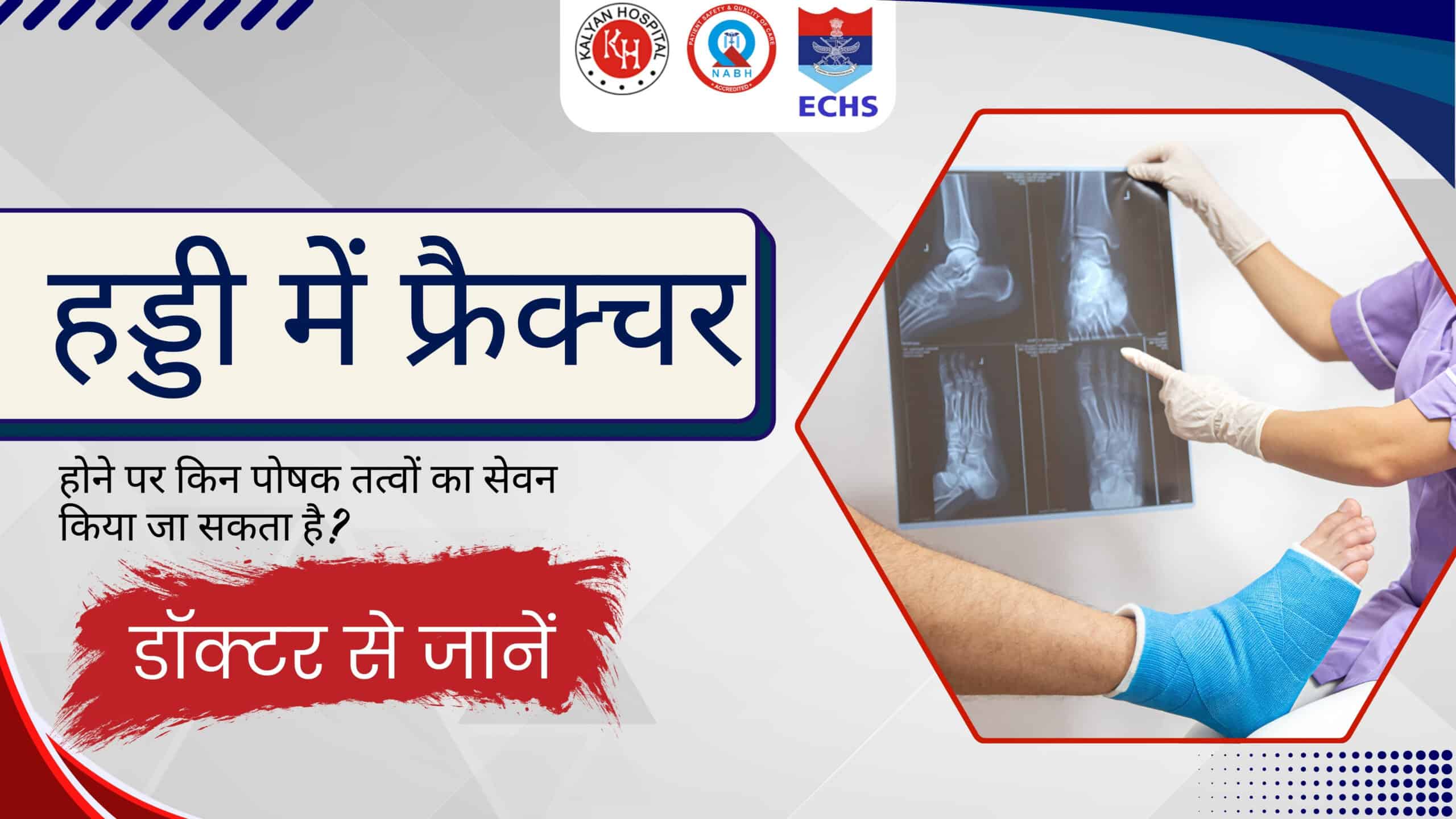 This image describes about what-nutrients-can-be-consumed-after-a-bone-fracture