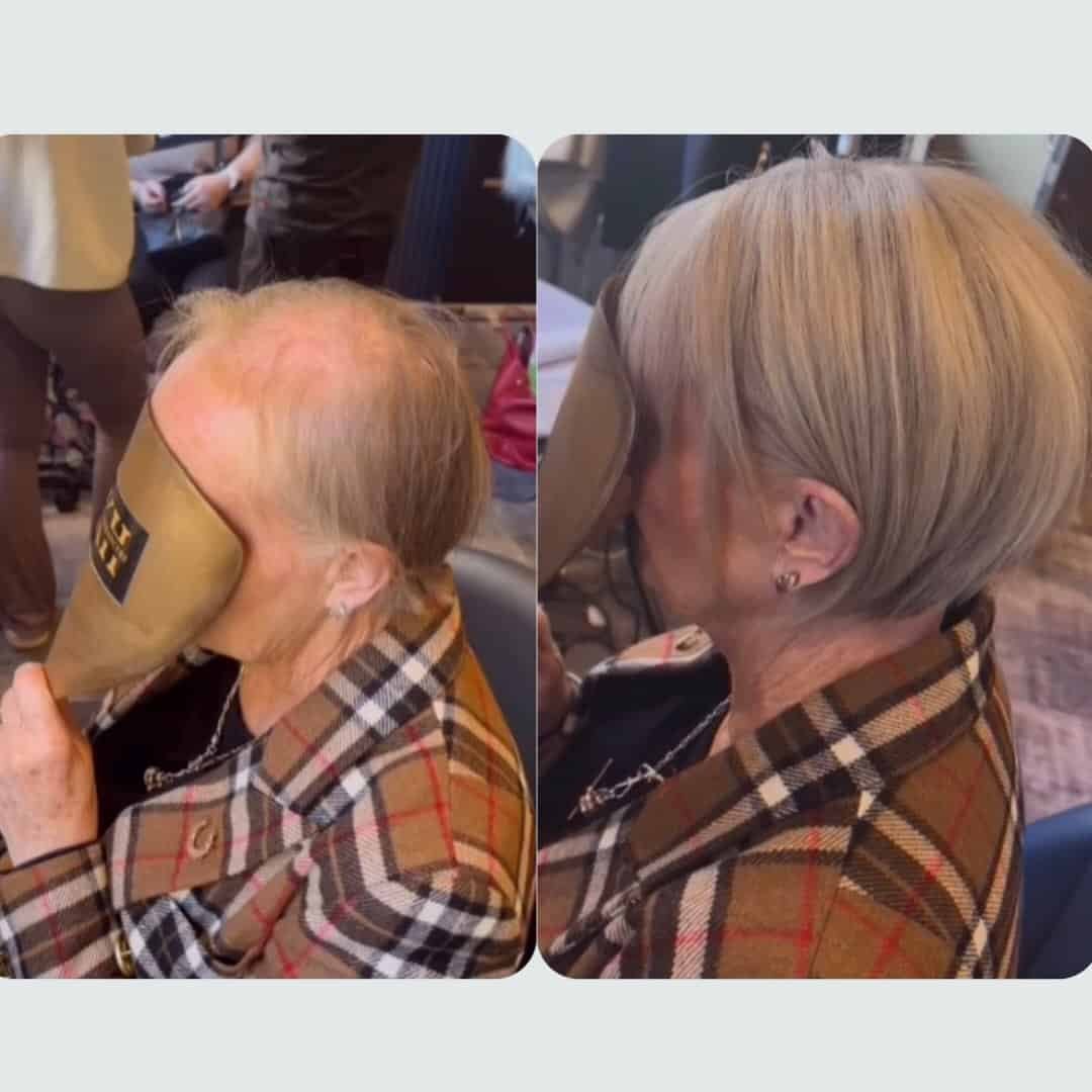 Before and after hair transformation of an elderly woman with hair enhancements.