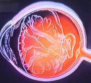 Glaslegemet med indtegnet lobuleret struktur