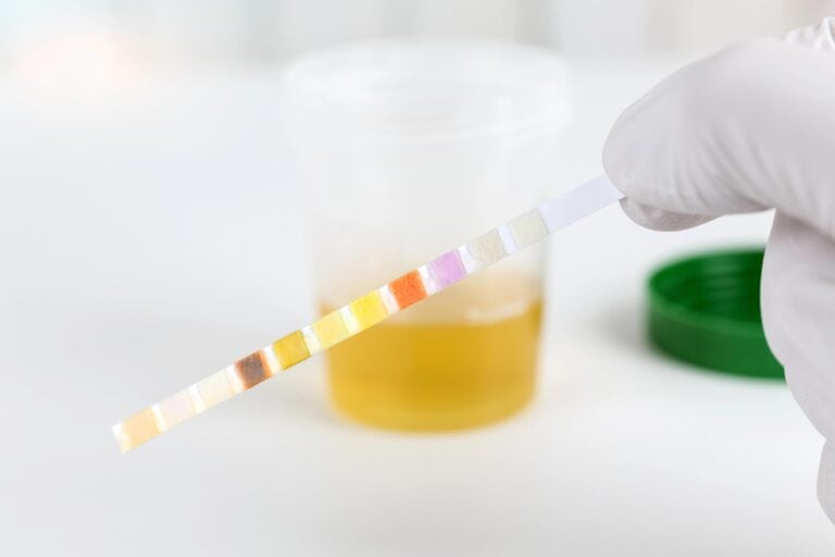 do shrooms show up on a urine test
