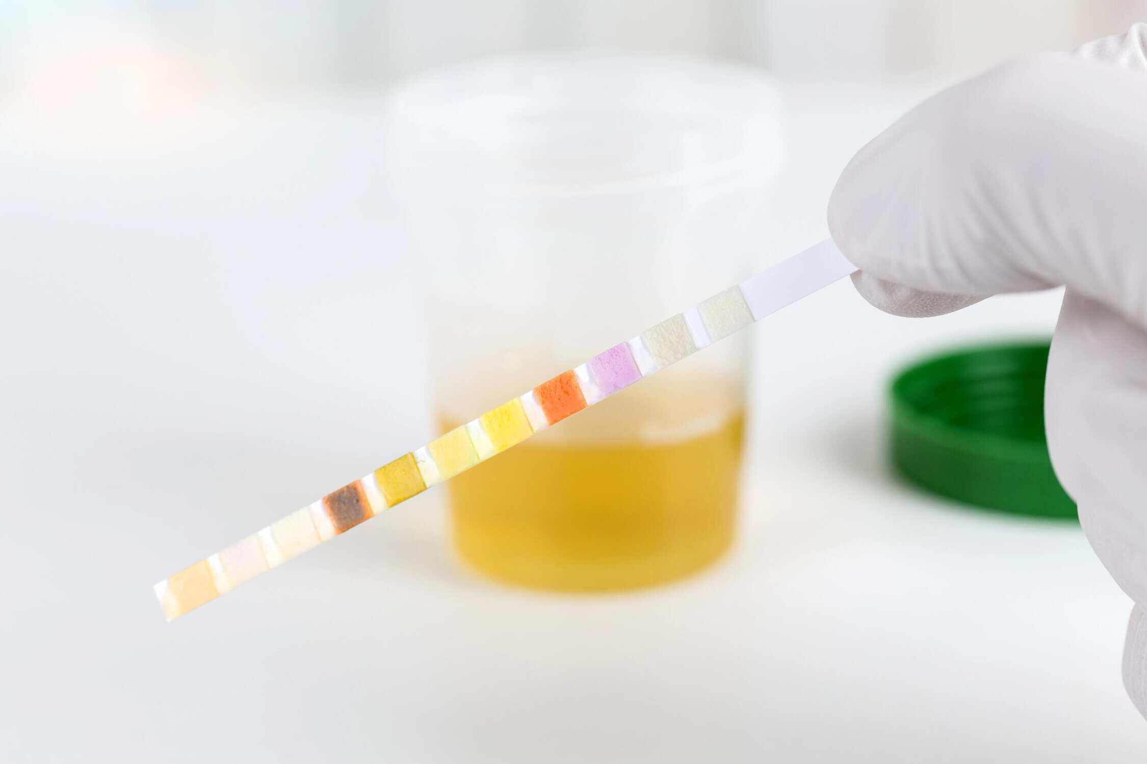do shrooms show up on a urine test