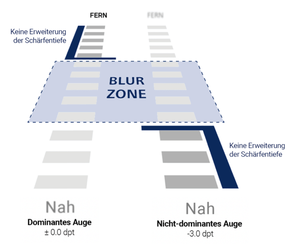 Presbyond Blur Zone