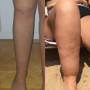 annelie-efter-op
