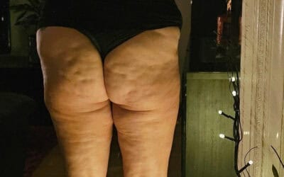 Att möta kropps-förändringar utan panik