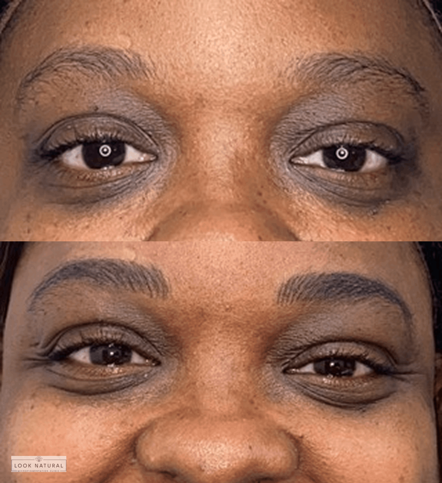 Before and after eyebrow restoration transforming thin brows into a fuller, defined shape.