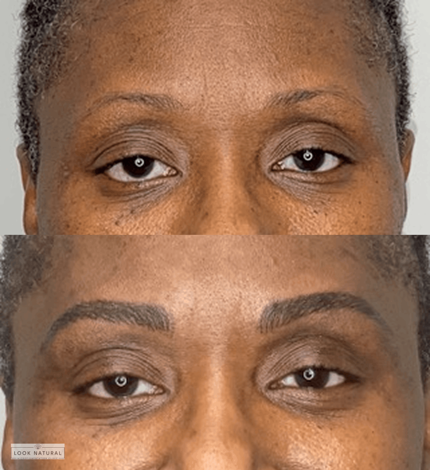 Before and after eyebrow restoration showing natural volume and beautifully shaped brows for a more defined look.