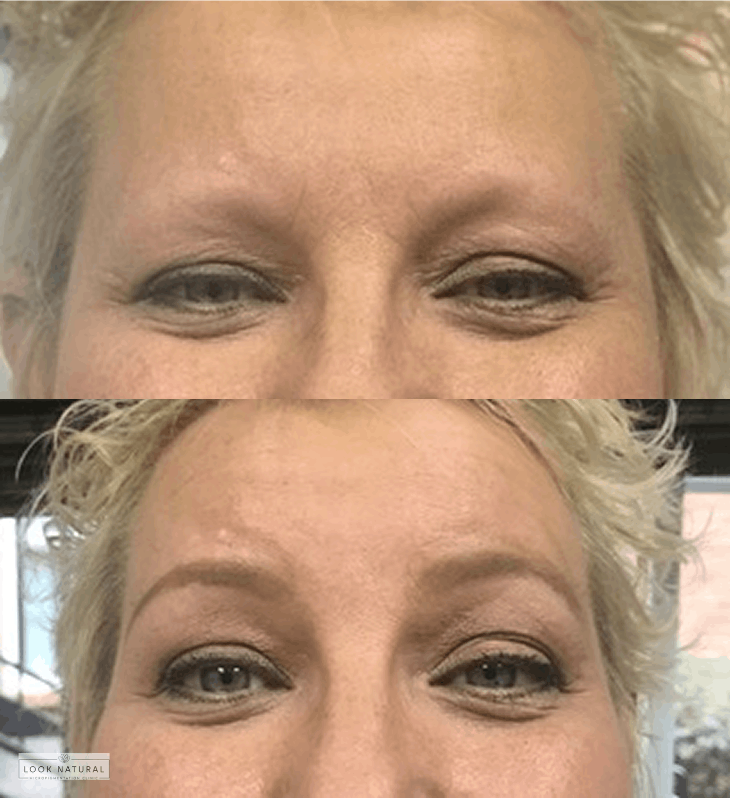 Before and after transformation showing restoration of very thin, almost invisible eyebrows to defined, natural brows.