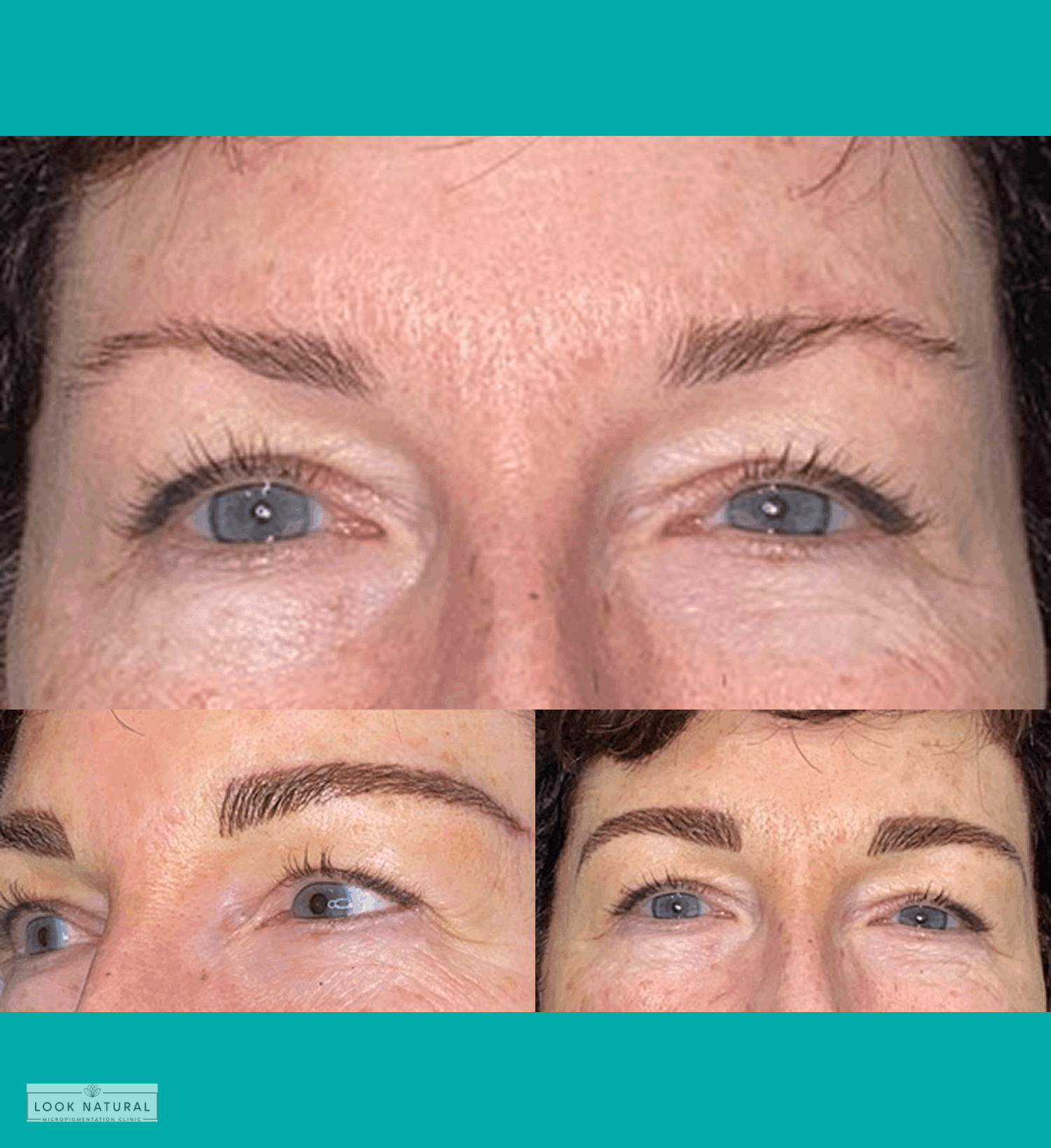 Before and after eyebrow restoration image showing transformation from thin, uneven brows to fuller and naturally shaped eyebrows.