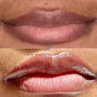 Two-panel close-up of lips: top shows natural lips, bottom shows lips with red lipstick and metallic sheen, with 'Look Natural Atlanta' branding across the center.