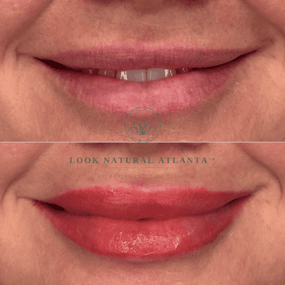 Before-and-after lips close-up: natural lips on top, fuller glossy red lips on bottom, with Look Natural Atlanta logo between.