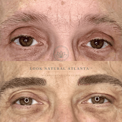 Close-up split image of a man’s eyes showing before (sparse brows) on top and after (full, defined brows) following micro-pigmentation, with a clinic watermark reading ‘Look NaturalAtlanta’ across the center.