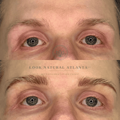 Before and after close-up of a person's eyes showing micro-pigmentation results, with a Look Natural Atlanta overlay across the middle.