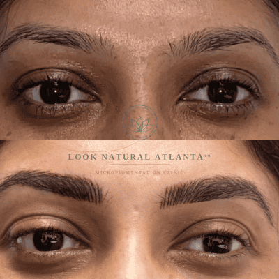 Before (top) and after (bottom) close-up of a woman’s eyes and brows showing brow micro-pigmentation results at Look Natural Atlanta.