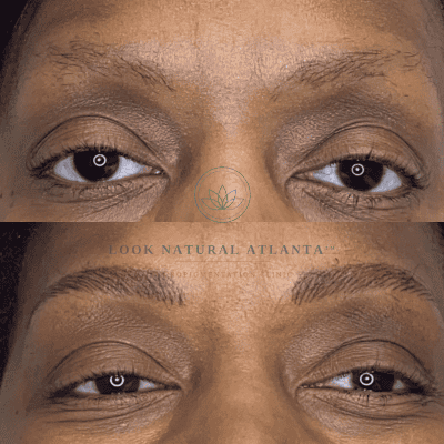 Top image shows a close-up of a woman's eyes with sparse eyebrows; bottom image shows fuller, shaped brows after treatment, with 'Look Natural Atlanta' watermark across the middle.