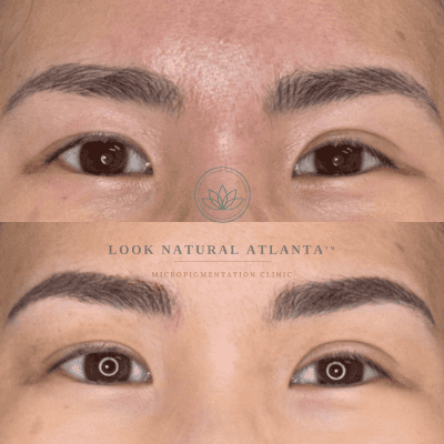 Before-and-after close-up of a woman's eyes and eyebrows, showing micro-pigmentation improvement with fuller, well-defined brows.