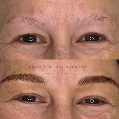 Before (top) and after (bottom) close-up of a woman's eyes and brows, showing fuller, well-defined eyebrows after micro-pigmentation at Look Natural Atlanta.