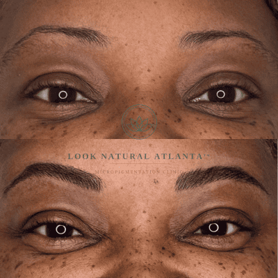 Before-and-after close-up of a woman’s eyes showing freckles and eyebrow micro-pigmentation: sparse brows above, fuller brows below.