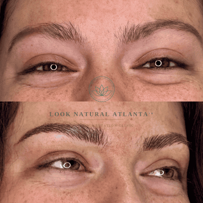 Before and after of an eyebrow transformation: top image shows sparse brows, bottom image shows fuller, well-defined arches on a freckled face.