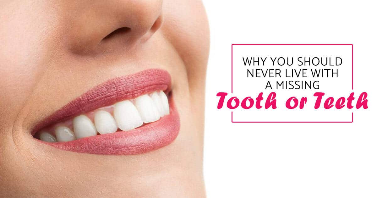 Missing tooth replacement dental clinic Ludhiana, best dental care, smile restoration, cosmetic dentistry Ludhiana, Ludhiana Dental Centre.