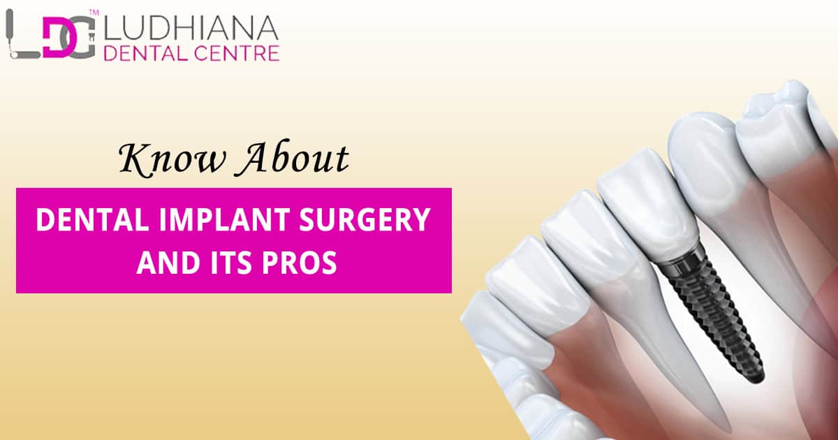 Dental-implant-surgery-pros-ludhiana-dental-centre.