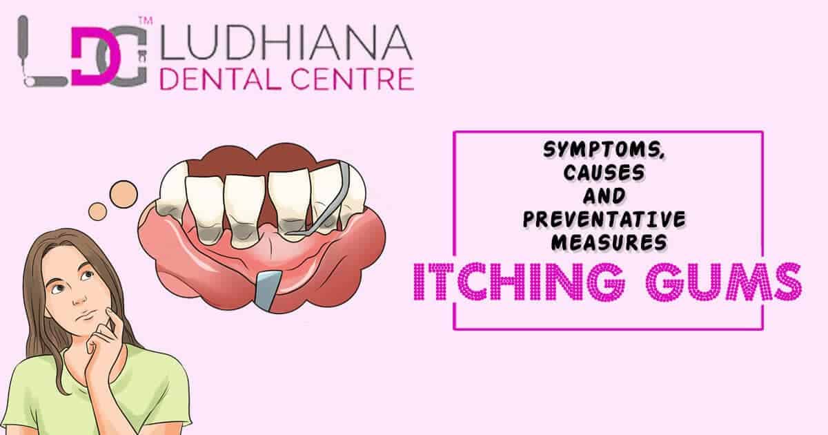 Dental-itching-gums-symptoms-causes-preventive-measures.jpg.