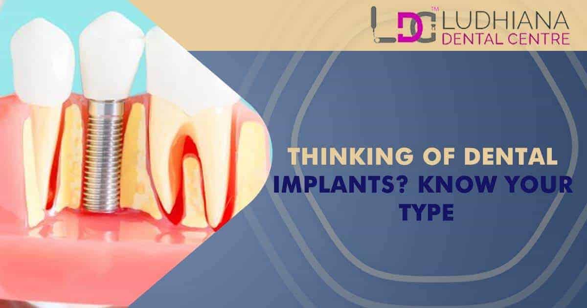 Dental implants Ludhiana Dental Centre, check your implant type today.