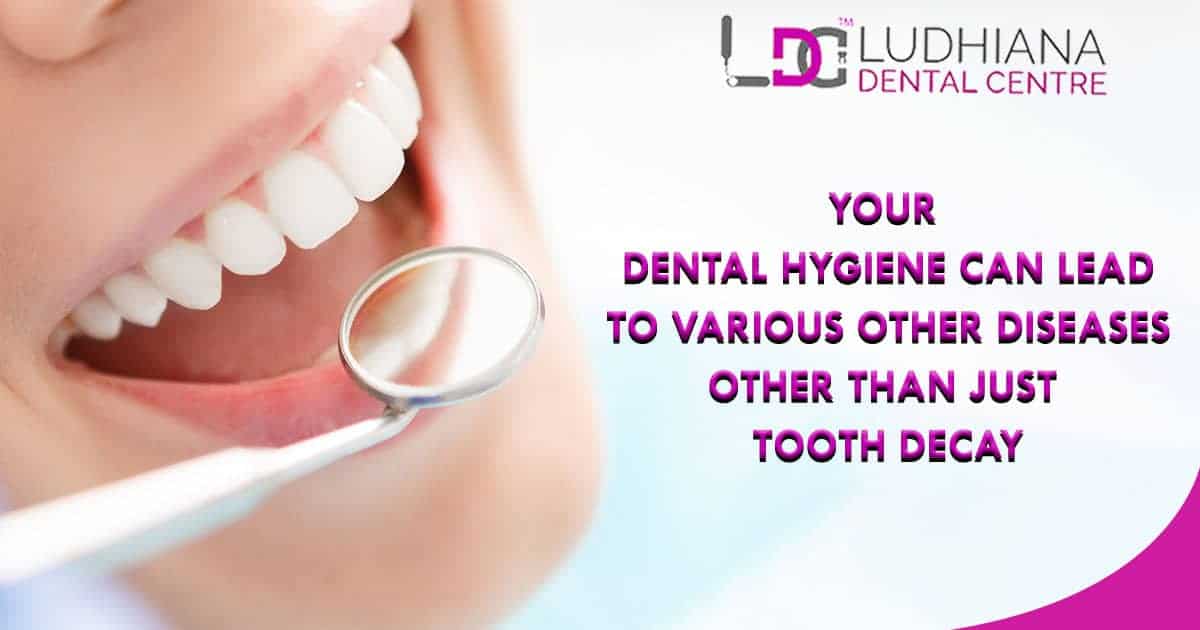 Mouth care and dental hygiene at Ludhiana Dental Centre.