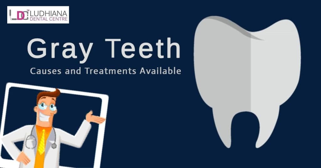 Gray teeth causes and treatments at Ludhiana Dental Centre for dental health.