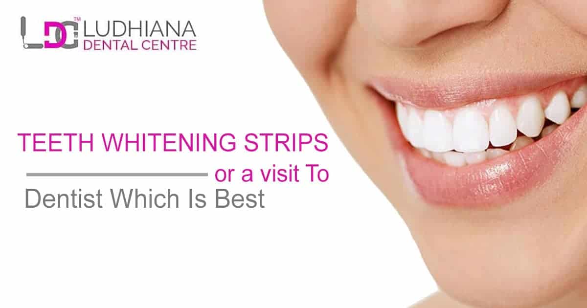 Bright smile with teeth whitening strips at Ludhiana Dental Centre for a healthy, beautiful smile.