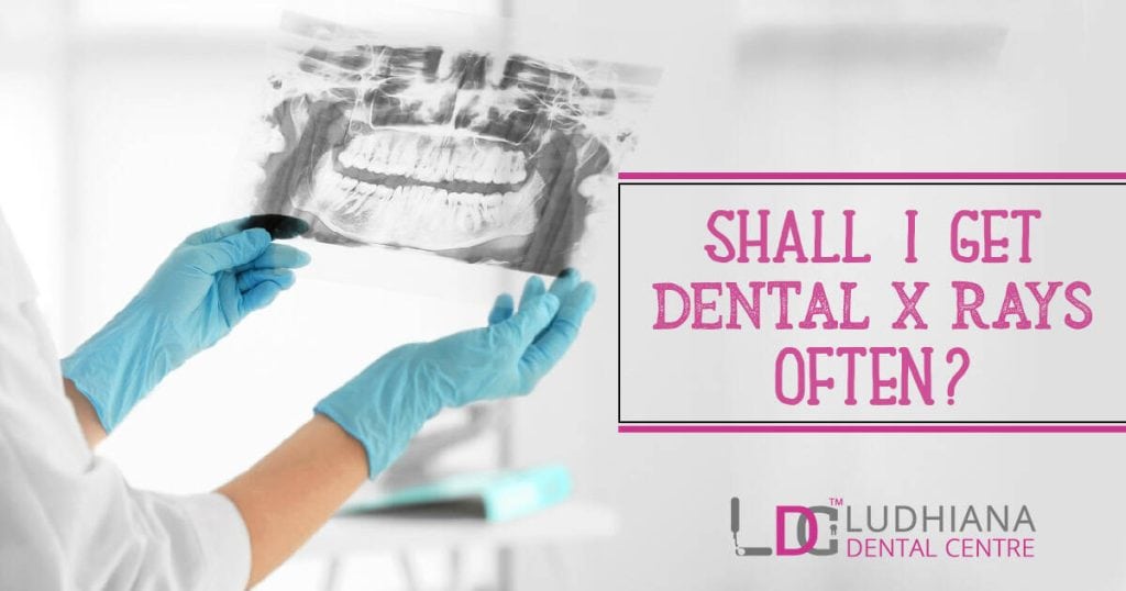 Dental X-rays for oral health assessment at Ludhiana Dental Centre.