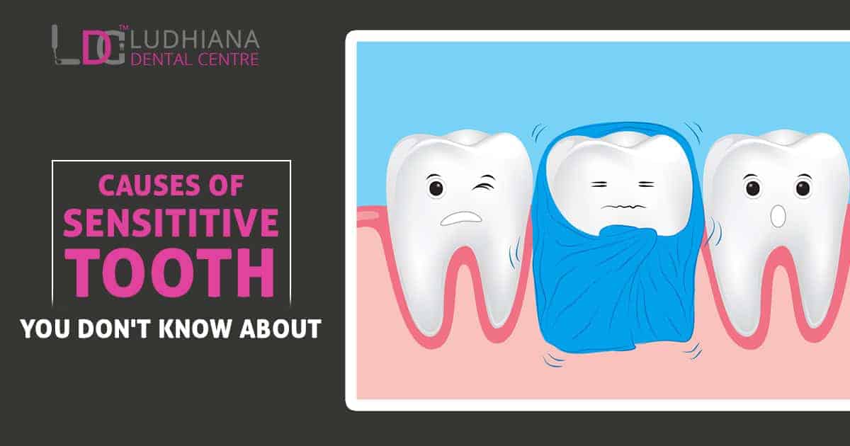 Sensitive tooth pain causes and treatment at Ludhiana Dental Centre, your trusted dental clinic.