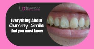 Gummy smile treatment Ludhiana Dental Centre, cosmetic dentistry for gummy smile correction.