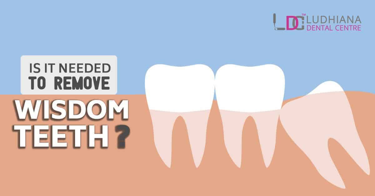 Removal of wisdom teeth at Ludhiana Dental Centre.