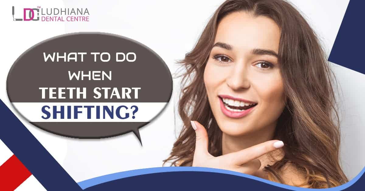 Clear dental care tips for teeth shifting at Ludhiana Dental Centre, expert advice on handling teeth movement.