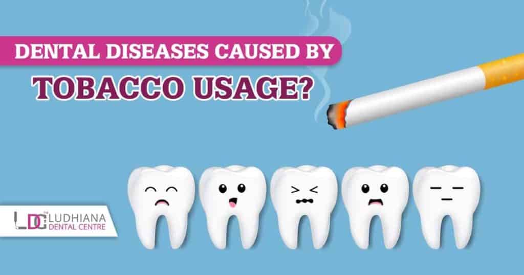Toothache caused by tobacco use Dental health risks from smoking at Ludhiana Dental Centre.