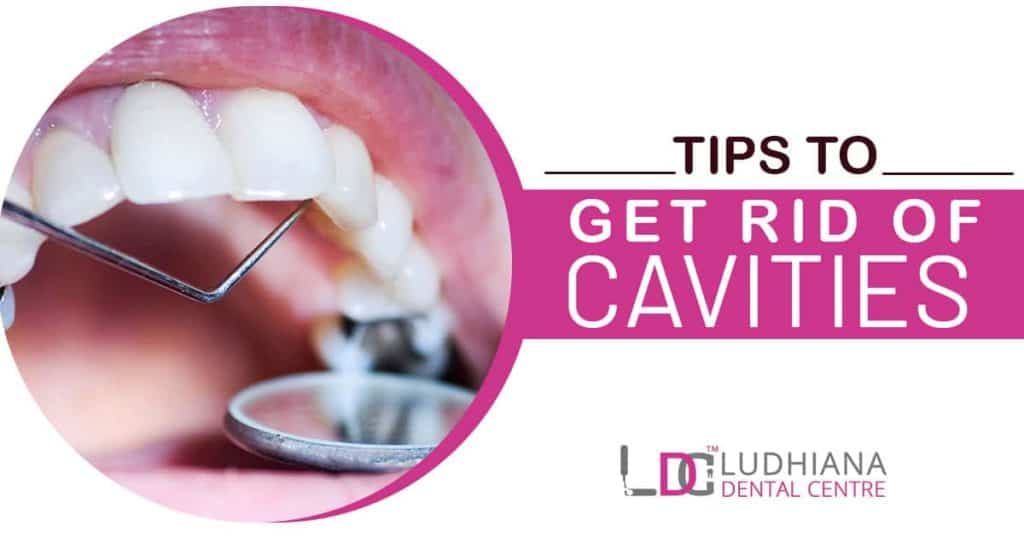 White dental cavity filling procedure at Ludhiana Dental Centre.
