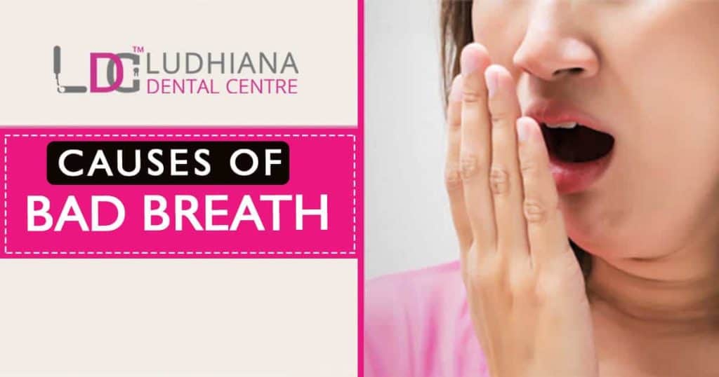 Causes of bad breath and dental health tips at Ludhiana Dental Centre.