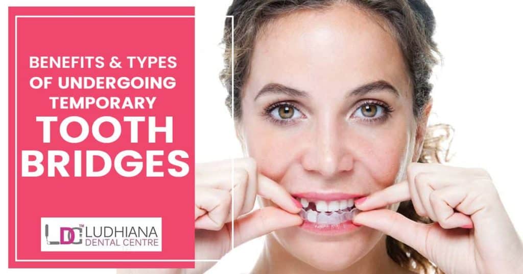 Clear temporary tooth bridge for dental restoration at Ludhiana Dental Centre.