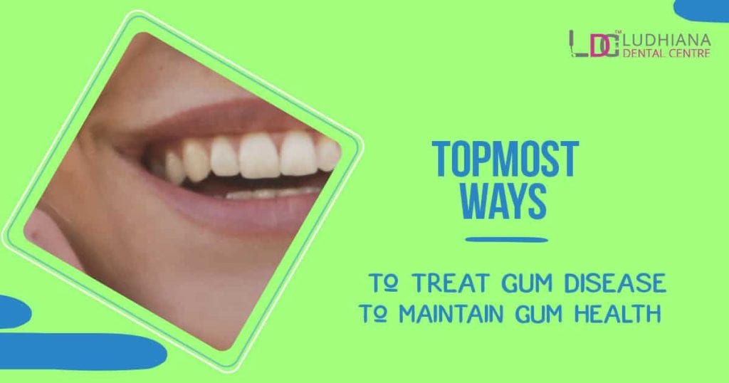 Natural teeth with healthy gums at Ludhiana Dental Centre for optimal gum health and disease prevention.