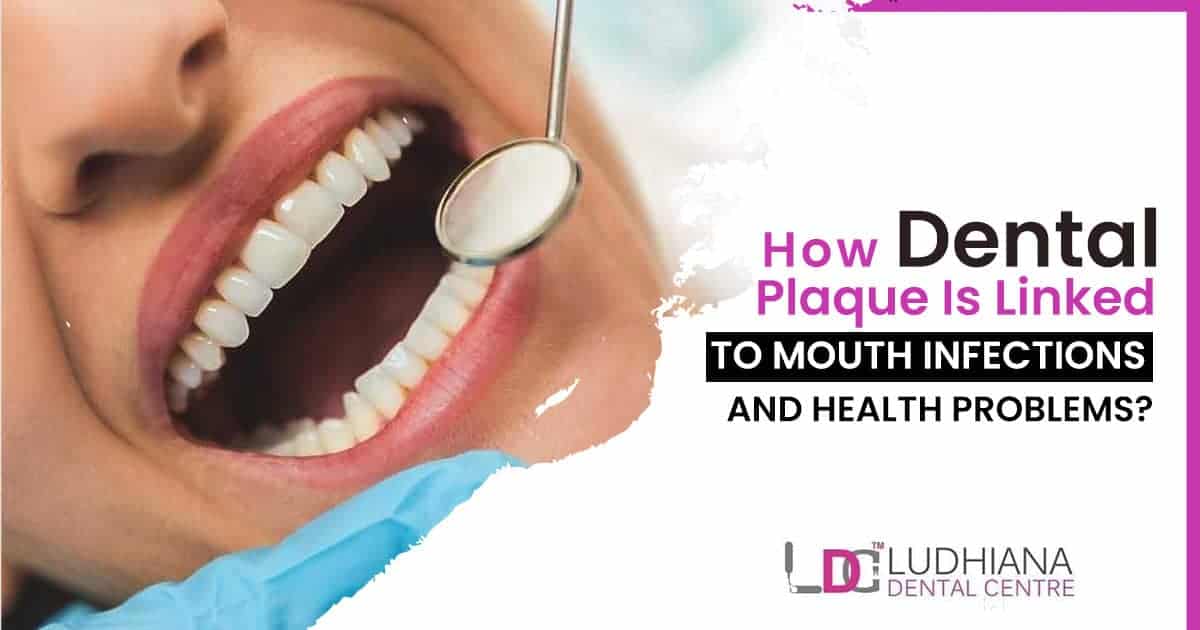 Bright smile with dental mirror showing oral health and plaque issues from Ludhiana Dental Centre.